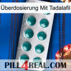 Überdosierung Mit Tadalafil dapoxetine1